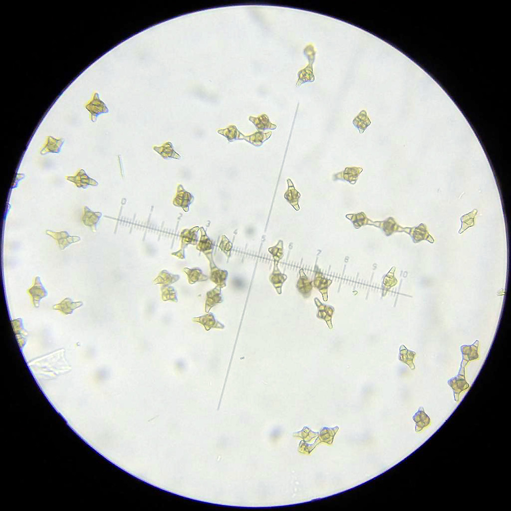 Phragmotrichum chailletii, mikro snímek výtrusů - foto: Petr Souček