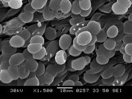 SEM 1500x