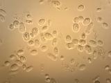 Saccharomyces cerevisiae