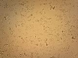 Saccharomyces cerevisiae