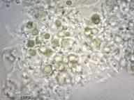 fotosymbiont