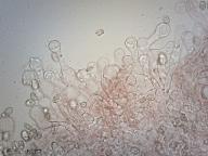 Cheilocystidy