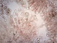 Cheilocystidy