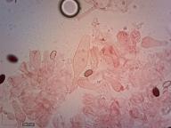 bazidie a pleurocystida
