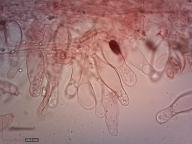 cheilocystidy