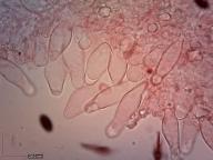 cheilocystidy