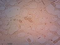 hymenofor
