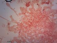 cheilocystidy