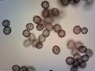 zralé výtrusy zralé výtrusy