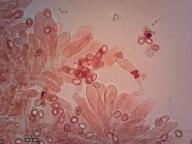 cheilocystidy