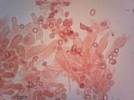 cheilocystidy
