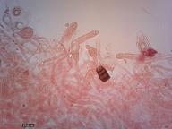 dermatocystidy