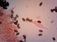 pleurocystidy