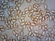 zralé výtrusy (H2O) zralé výtrusy (H2O)