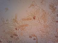 cheilocystidy (KOH 5%)