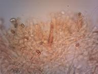 cheilocystidy (KOH 5%)