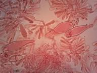 pleurocystidy (kongo červeň NH3)