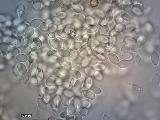 Strobilurus stephanocystis 