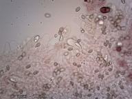 cheilocystidy (H2O)