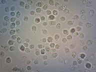 zralé výtrusy (H2O) zralé výtrusy (H2O)