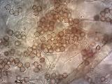 Lycoperdon utriforme 