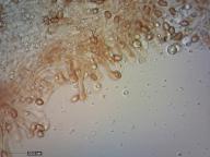 cheilocystidy (KOH 5%)