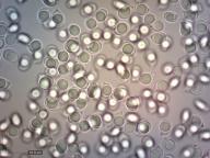 zralé výtrusy (H2O) zralé výtrusy (H2O)