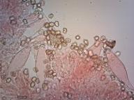 pleurocystidy (kongo červeň NH3)