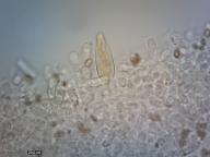 pleurocystidy (KOH)