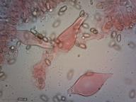 pleurocystidy (kongo červeň NH3)