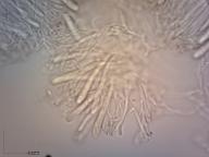 vřecka s výtrusy a parafýzy (Melzerovo činidlo) vřecka s výtrusy a parafýzy (Melzerovo činidlo)