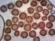 výtrusy (KOH 10%) výtrusy (KOH 10%)