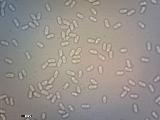 Baeospora myosura 