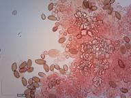 cheilocystidy (kongo červeň NH3) cheilocystidy (kongo červeň NH3)