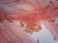 kaulocystidy (kongo červeň NH3) kaulocystidy (kongo červeň NH3)