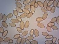 zralé výtrusy (H2O) zralé výtrusy (H2O)