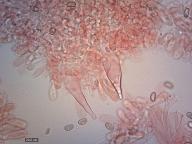 pleurocystidy (kongo červeň NH3)