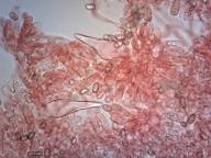 pleurocystidy (kongo červeň NH3)