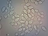 Cylindrobasidium evolvens 