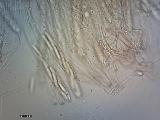 Ascocoryne cylichnium 