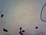 cheilocystidy (kongo červeň NH3)