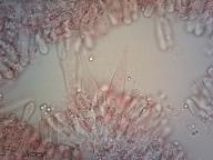 pleurocystidy (kongo červeň NH3)