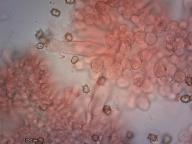 pleurocystidy (kongo červeň NH3)