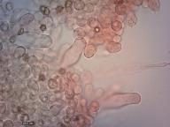 pleurocystidy (kongo červeň NH3)