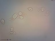 Guepinia helvelloides 