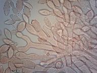 Monilinia fructigena 