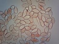 Monilinia fructigena 