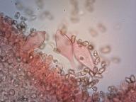 pleurocystidy (kongo červeň NH3)