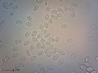 Climacocystis borealis 