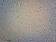 zralé výtrusy (H2O) zralé výtrusy (H2O)